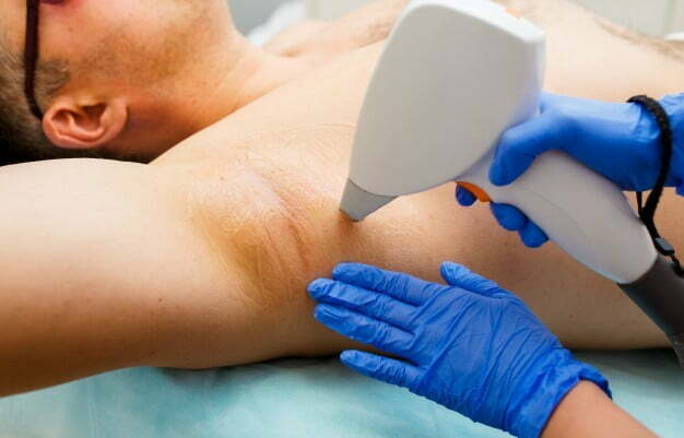 hair removal treatments