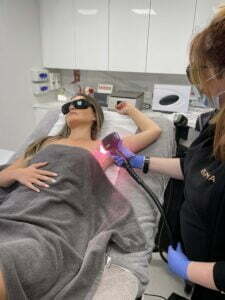 when to get laser hair removal