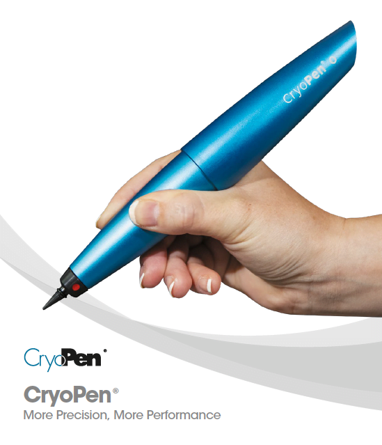 cryopen treatment Southampton